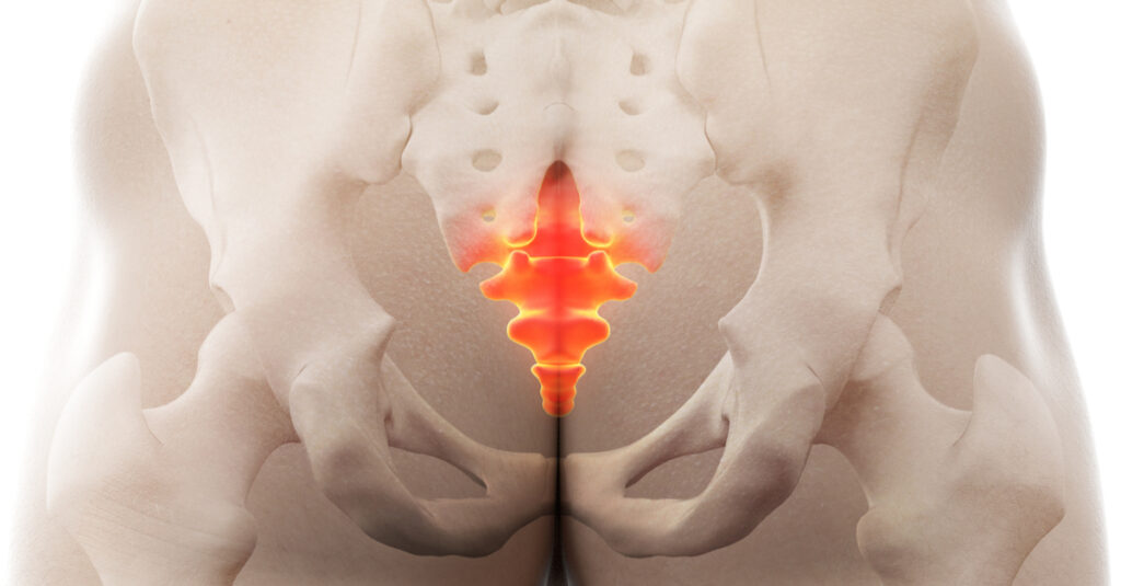 coccigodinia cose rimedi